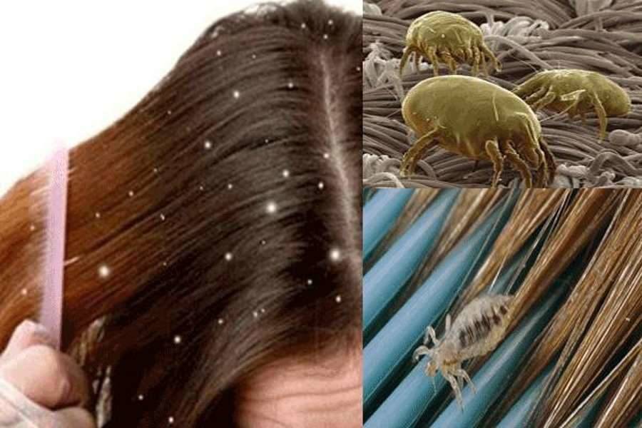 Живут ли вши на окрашенных волосах