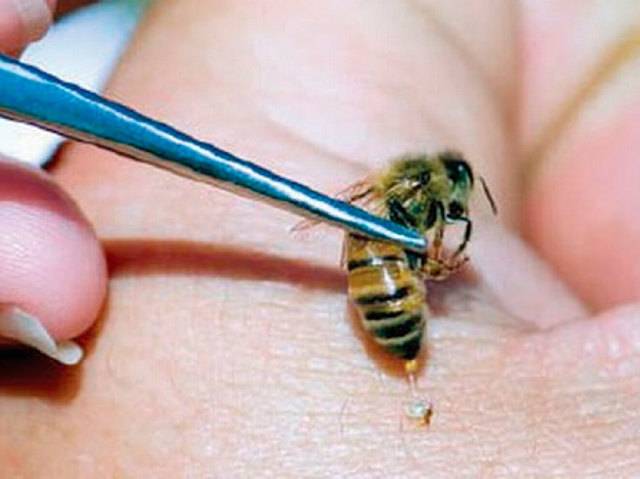 Причины гибели пчел