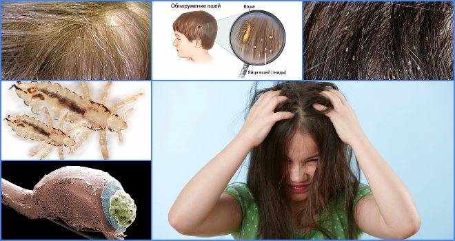 Живут ли вши на окрашенных волосах: воздействие краски