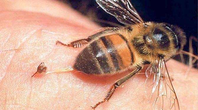 Укус пчелы, осы, что делать? первая помощь при укусе пчелы, осы, шершня.
