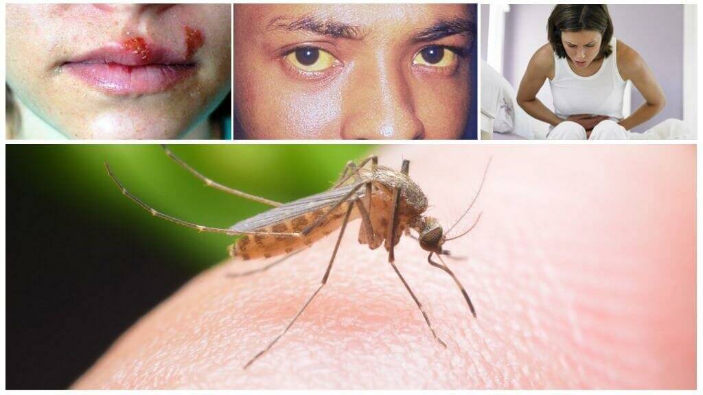 Может ли комар заразить гепатитом с
