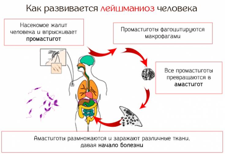 Кожный лейшманиоз у больных вич-инфекцией » библиотека врача