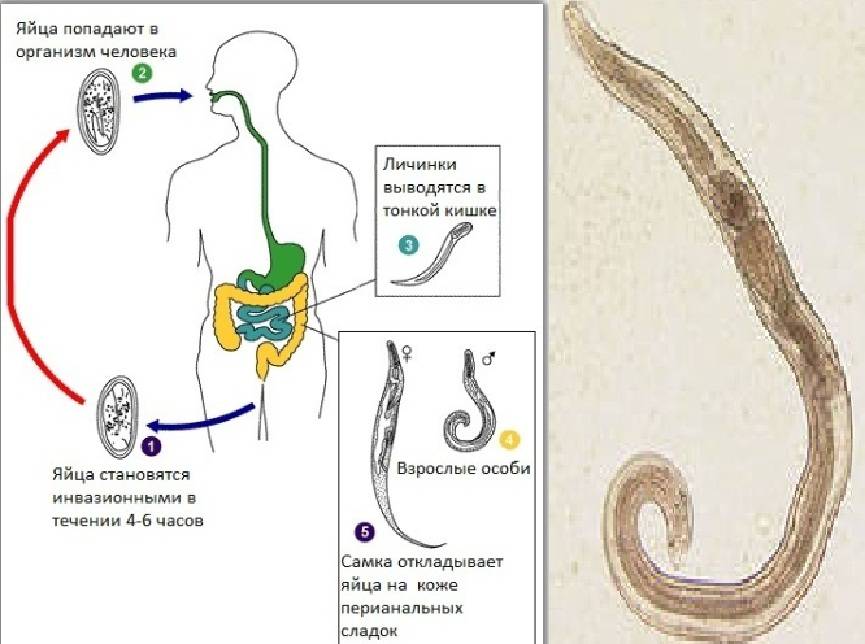 Откуда берутся черви. Острицы глисты гельминты. Острицы обитают в организме человека. Паразиты в организме человека острицы.