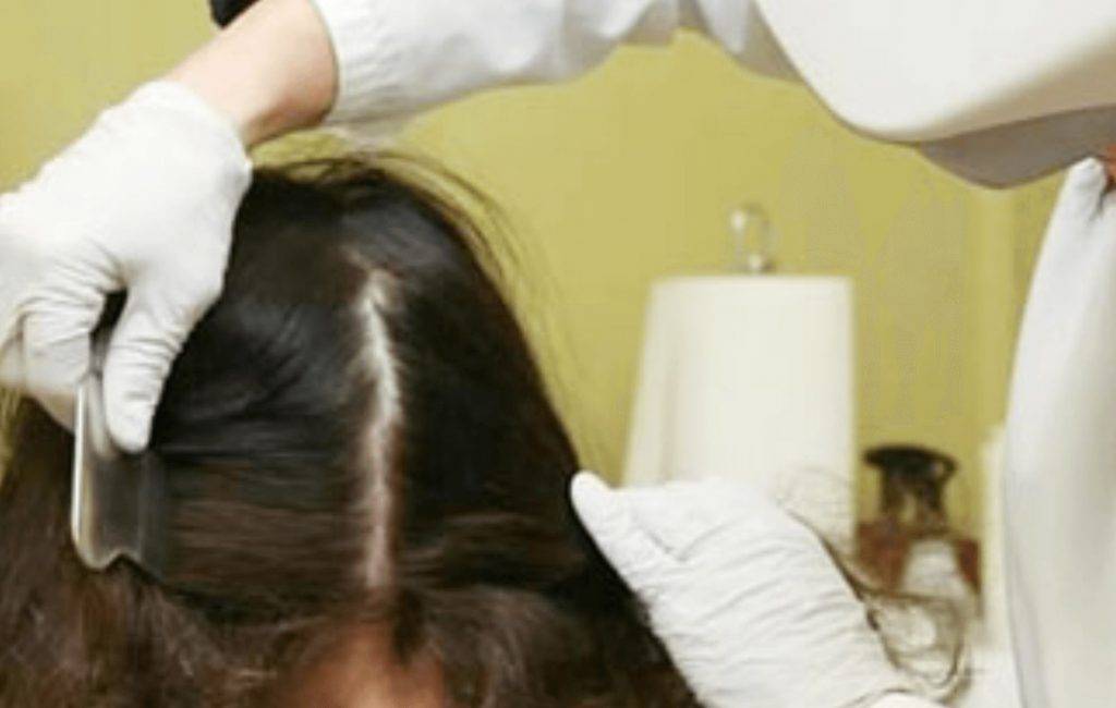 Обработка волосистой части головы при педикулезе: алгоритм действия