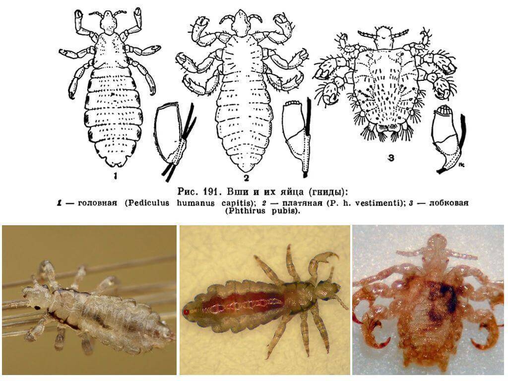 Схема развития pediculus humanus capitis olp