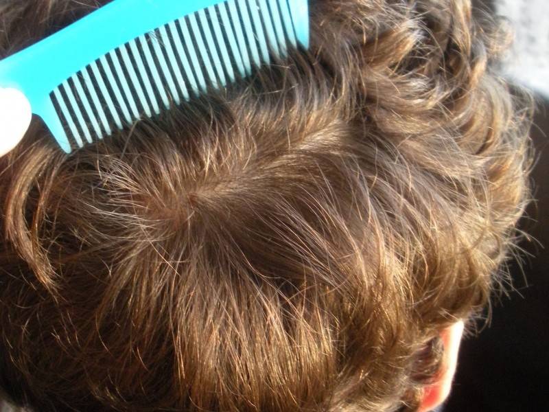 Убивает ли краска для волос вшей и гнид: нестандартное лечение педикулеза