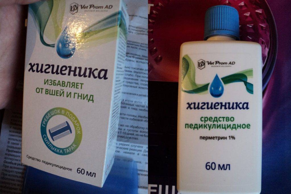 Педикулез