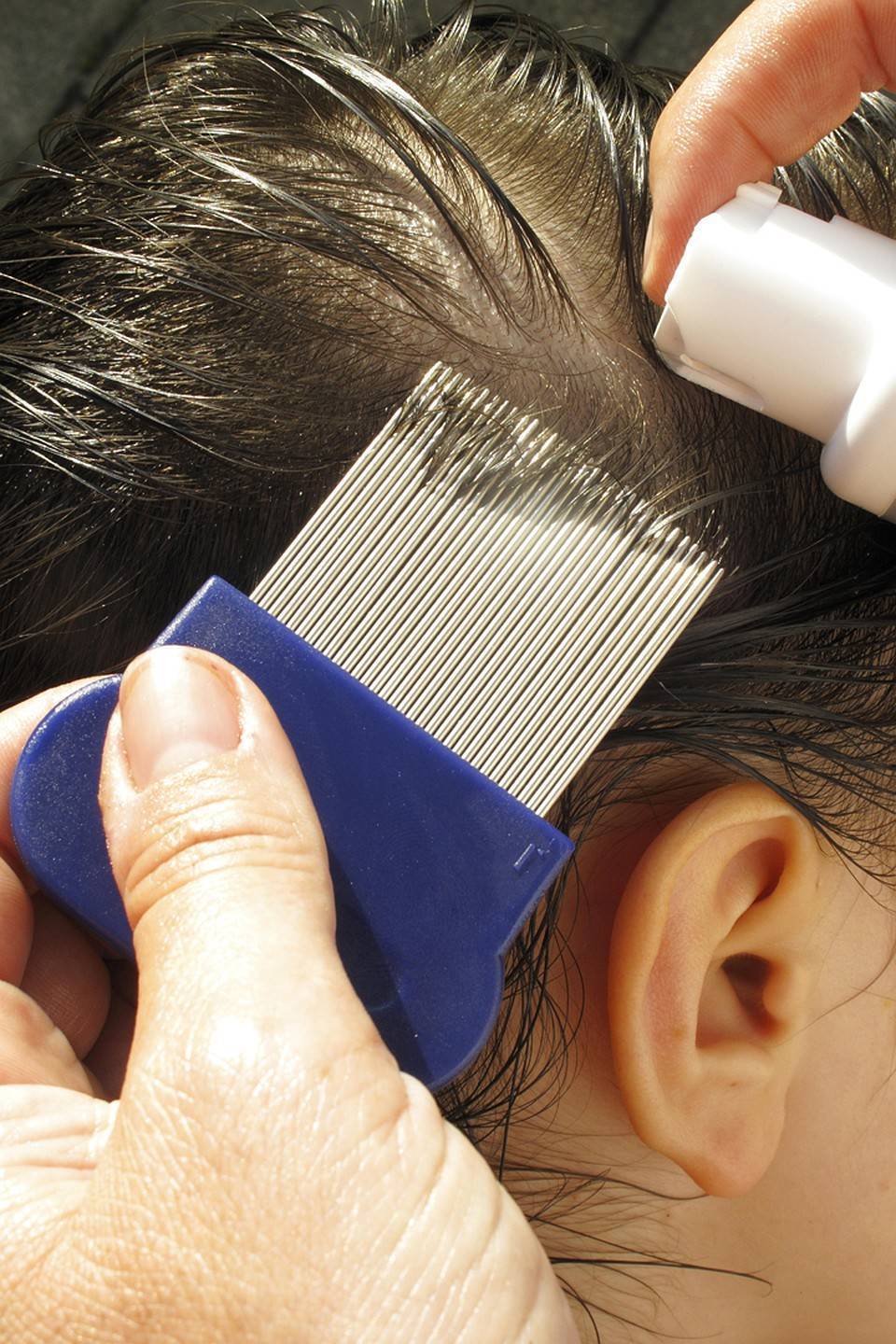 Советы по вычесыванию гнид из длинных и густых волос расческой