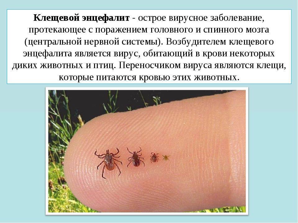 Чесотка: симптомы и лечение, как выглядит (фото)