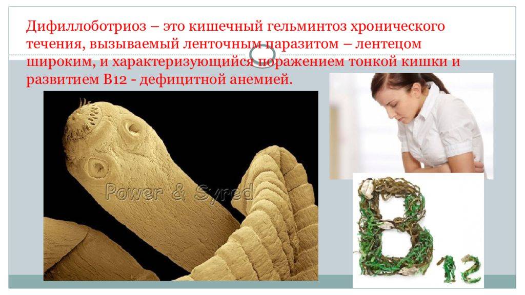 Полинейропатия
