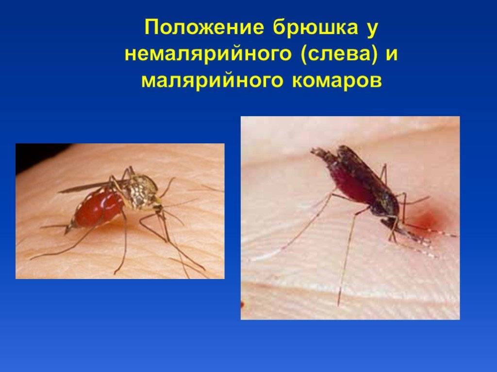 Первые признаки укусов малярийного комара, основные симптомы