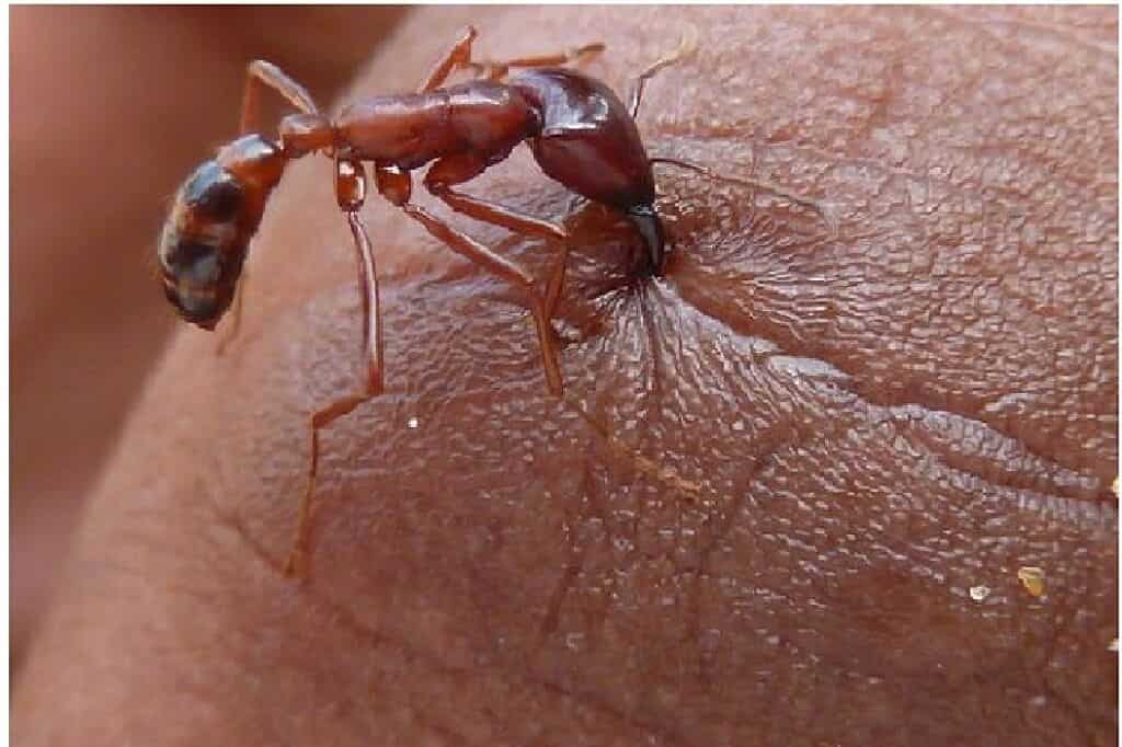 Укус муравья – фото и описание поражения кожи, чем лечить