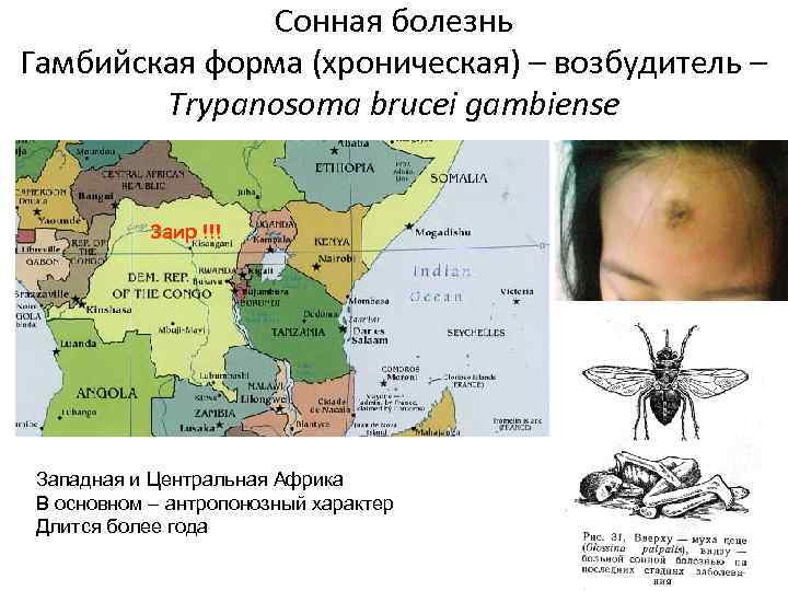 Сонная болезнь - что это такое, симптомы и лечение | prof-medstail.ru
