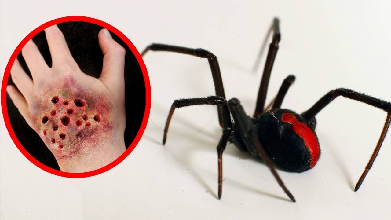 Внимание! ядовитые пауки идут в атаку! что делать при укусе крымского тарантула