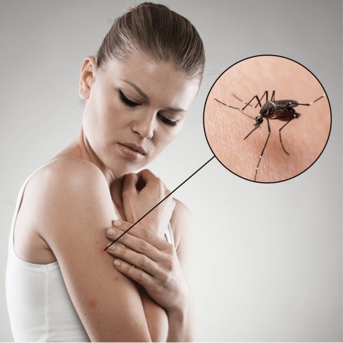 Комары летят на свет или на темноту. как видят комары и что их привлекает к человеку
