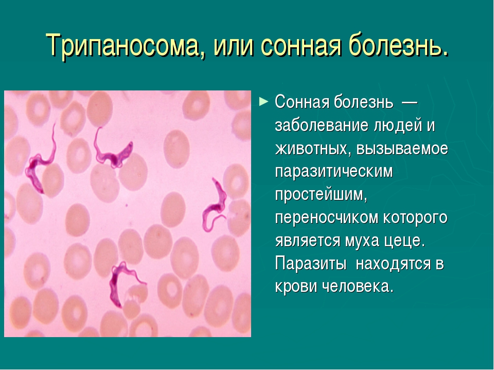 Сонная болезнь (трипаносомоз, болезнь шагаса): симптомы, что вызывает сонную болезнь, переносчики - medside.ru