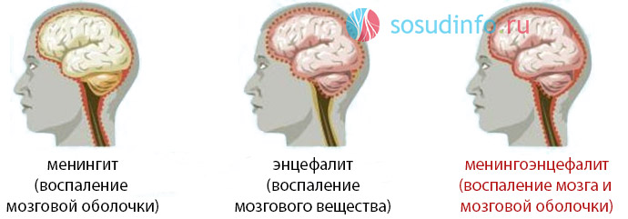 Прививка от клещевого энцефалита: частые вопросы и ответы