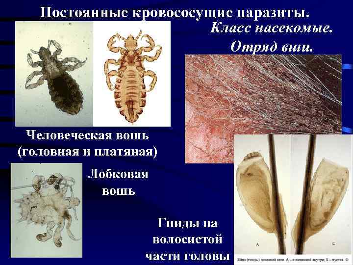 Мифы о вшах