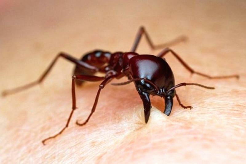Укус муравья: симптомы, лечение, народные средства, какая польза