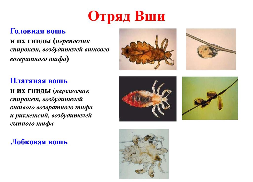 К какой группе возбудителей относятся вши