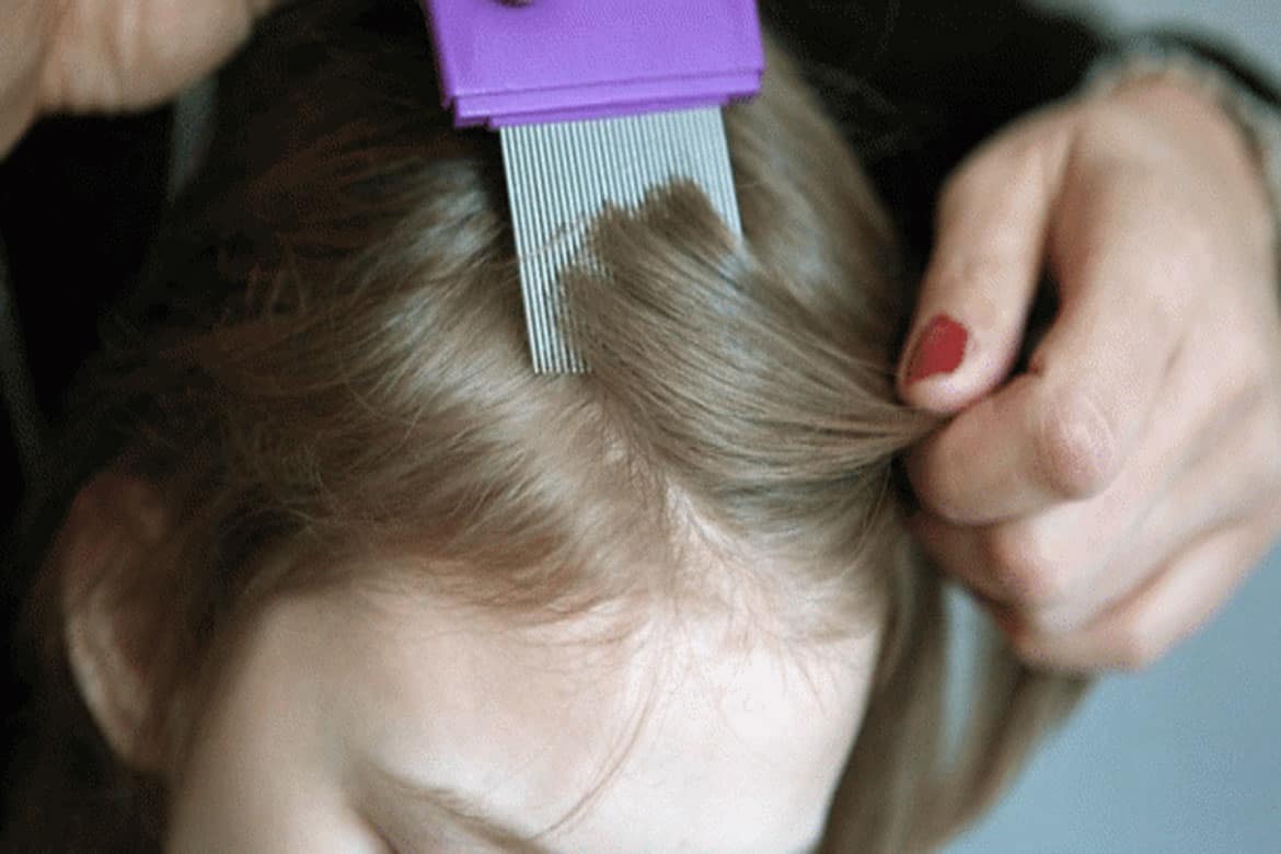 Как вывести вшей ребенка: с длинными волосами, за 1 день, в домашних условиях