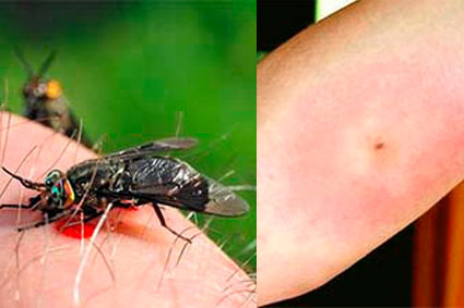 Укусы муравьёв – чем опасны, способы лечения