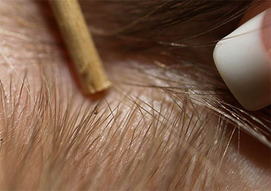 Живут ли вши на окрашенных волосах: убивает ли их краска?