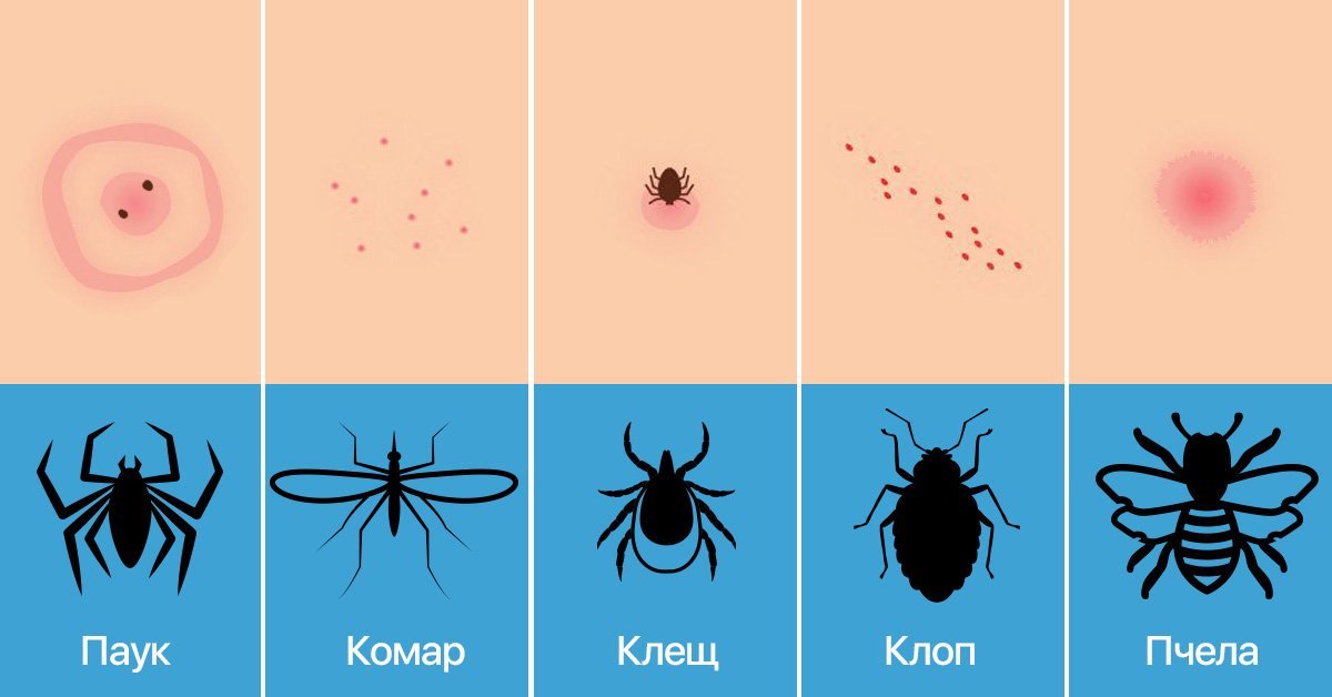 Как кусают блохи и как с ними бороться: лучшие методы и советы. как отличить укусы блох на человеке от укусов других кровососущих насекомых?