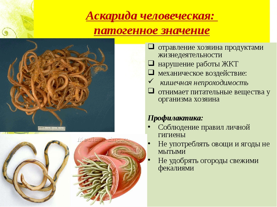 Гельминтозы у детей. Паразитические черви аскариды. Круглые черви аскарида человеческая. Тип круглые черви аскарида человеческая.