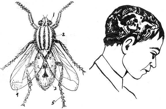 Вольфартова муха: образ жизни паразита, пути заражения и методы лечения вольфартиоза