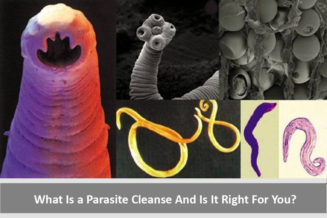 Зачем нас пугают паразитами? * клиника диана в санкт-петербурге