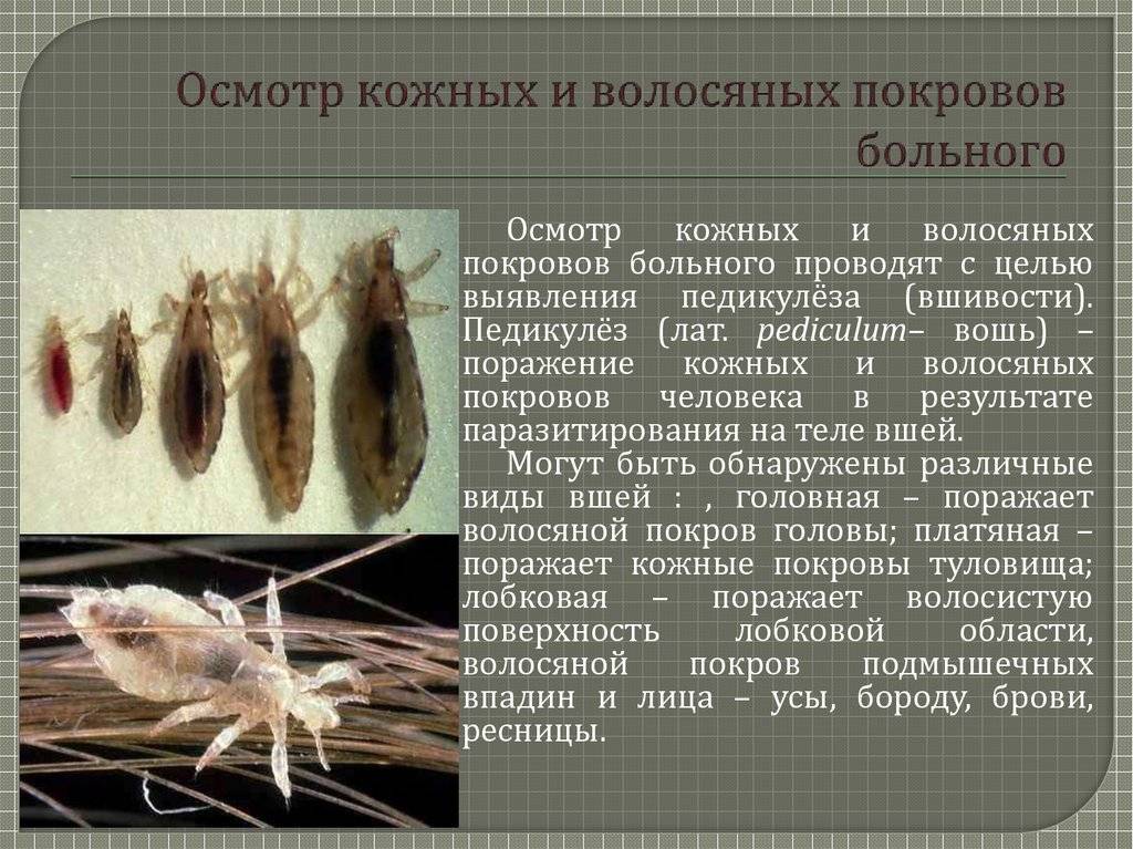 Как осматриваются контактные при госпитальном педикулезе