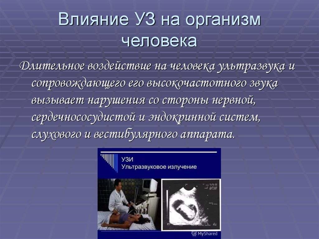 Выбираем лучшие отпугиватели мышей и крыс 2023 года