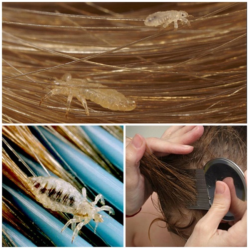 Убивает ли краска для волос вшей и гнид, плюсы и минусы процедуры