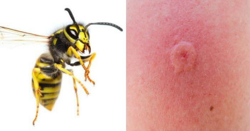 Первая помощь при укусе осы и опасность её яда