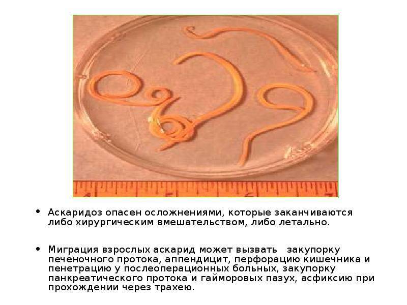 Виды круглых червей (нематоды): острицы, аскариды, угрица кишечная, трихинеллы, филярии  | признаки, лечение и диагностика вгкб № 2