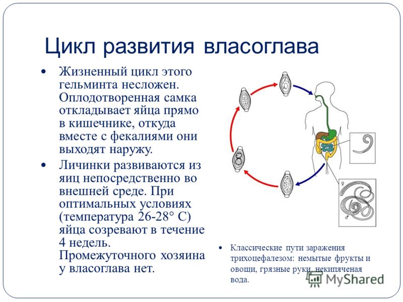 Жилище для власоглава – слепая кишка - rss - управление роспотребнадзора по республике марий эл