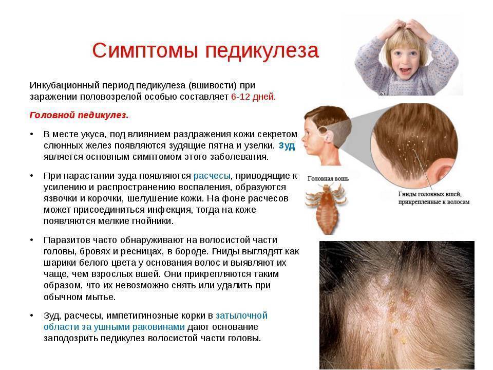 Педикулёз — детская поликлиника №5 г. мурманска
