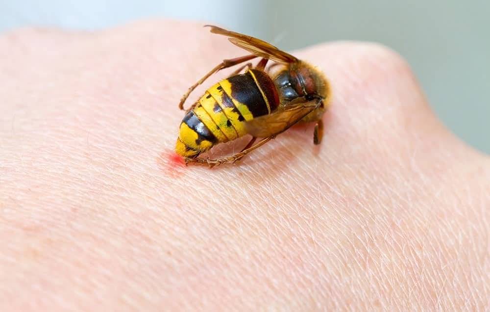 Чем лечить укус осы: советы врачей