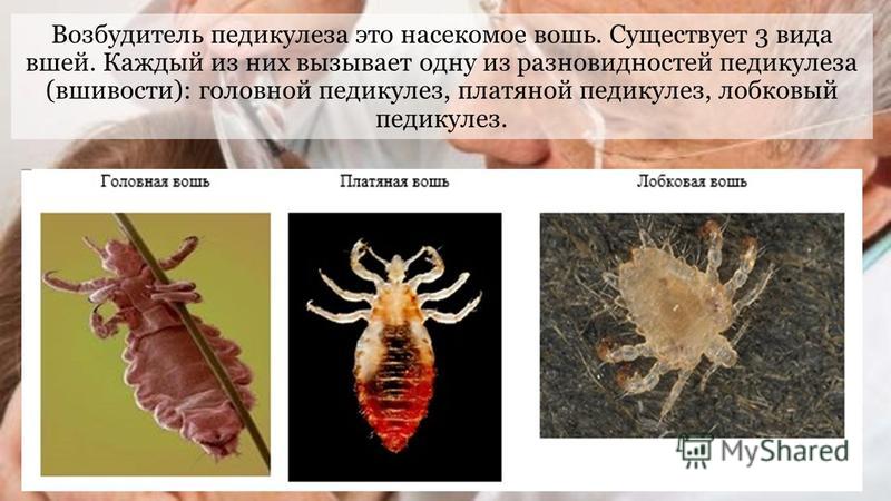 Педикулез: лечение в домашних условиях. чем лечить педикулез