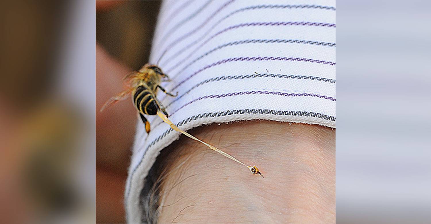 Укус пчелы: почему она умирает, первая помощь при отеке, а также польза и последствия