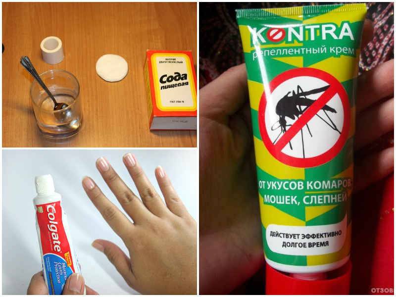 Чем мазать укусы комаров: самые эффективные аптечные и народные средства