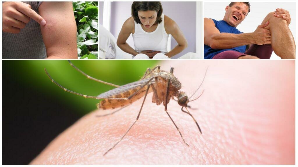 Аллергия на комариные укусы • аллергия и аллергические реакции