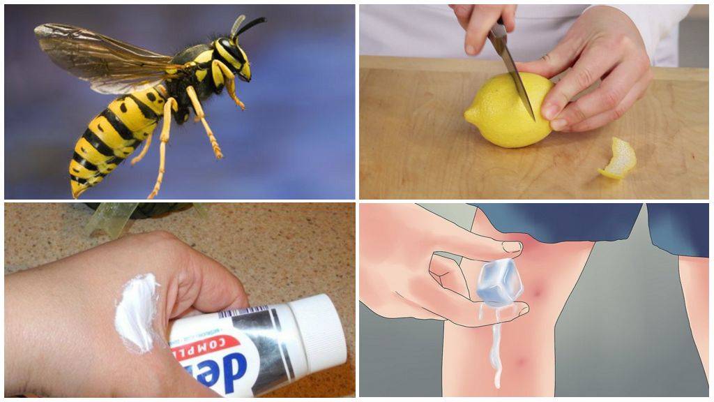 Укусила пчела: что делать и как оказать первую помощь, как снять опухоль и покраснение