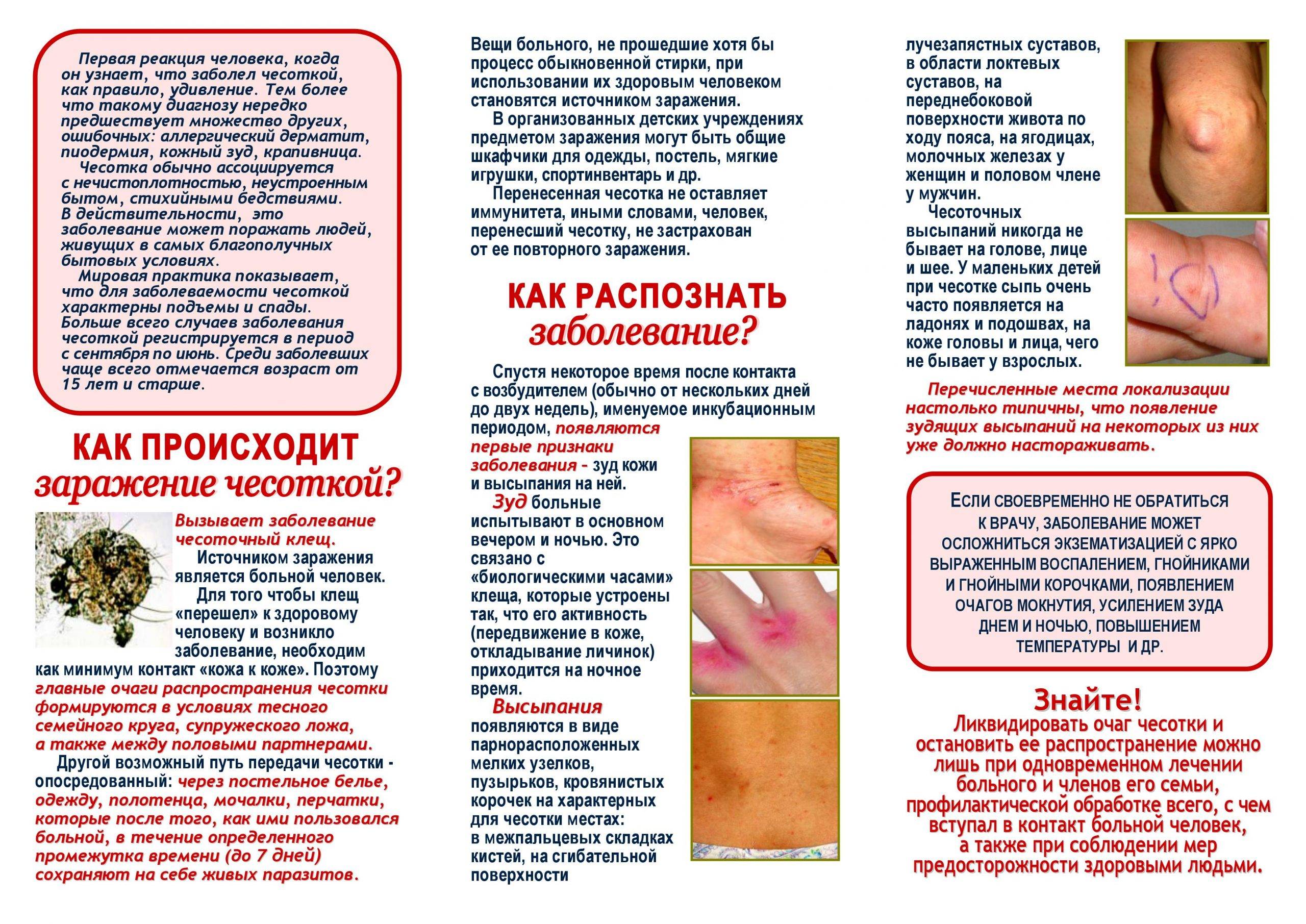 Чесотка | симптомы | диагностика | лечение - docdoc.ru