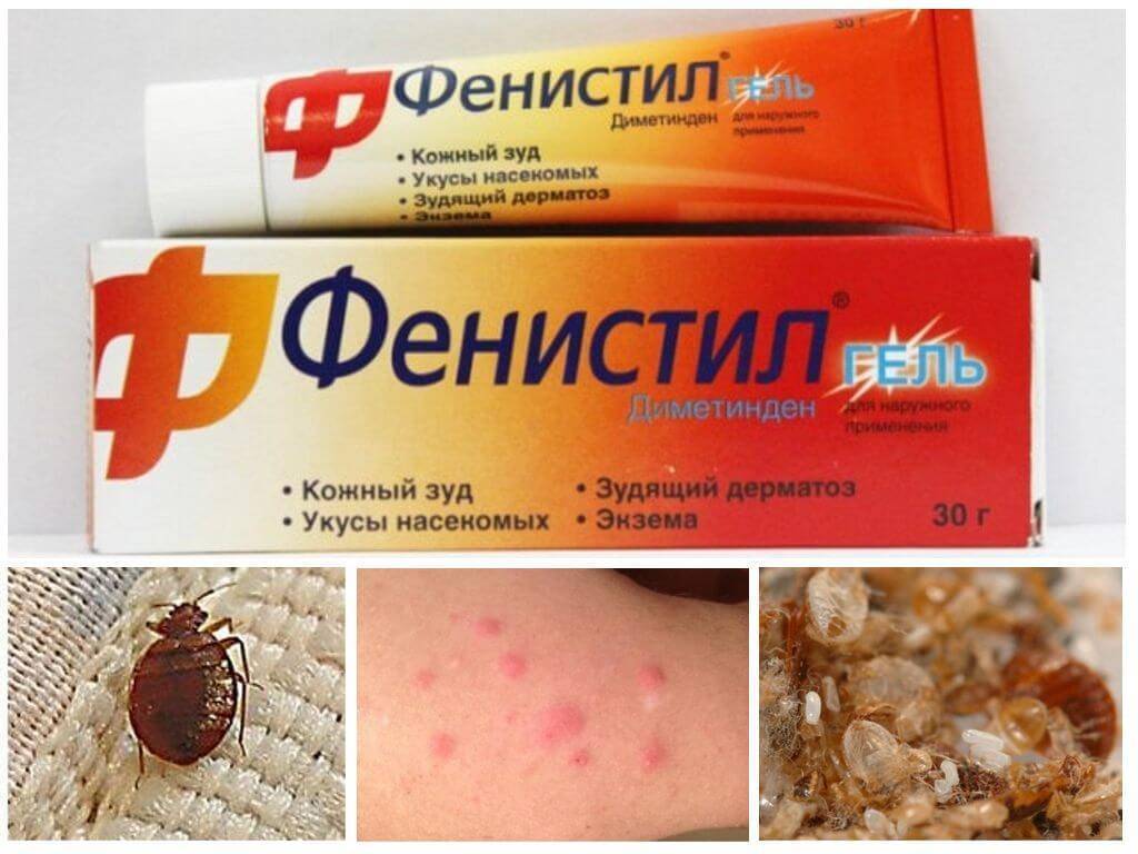 Укусы клопов на человеке – фото, описание и симптомы