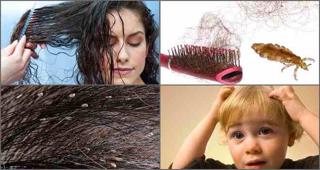 Убивает ли краска для волос вшей и гнид?