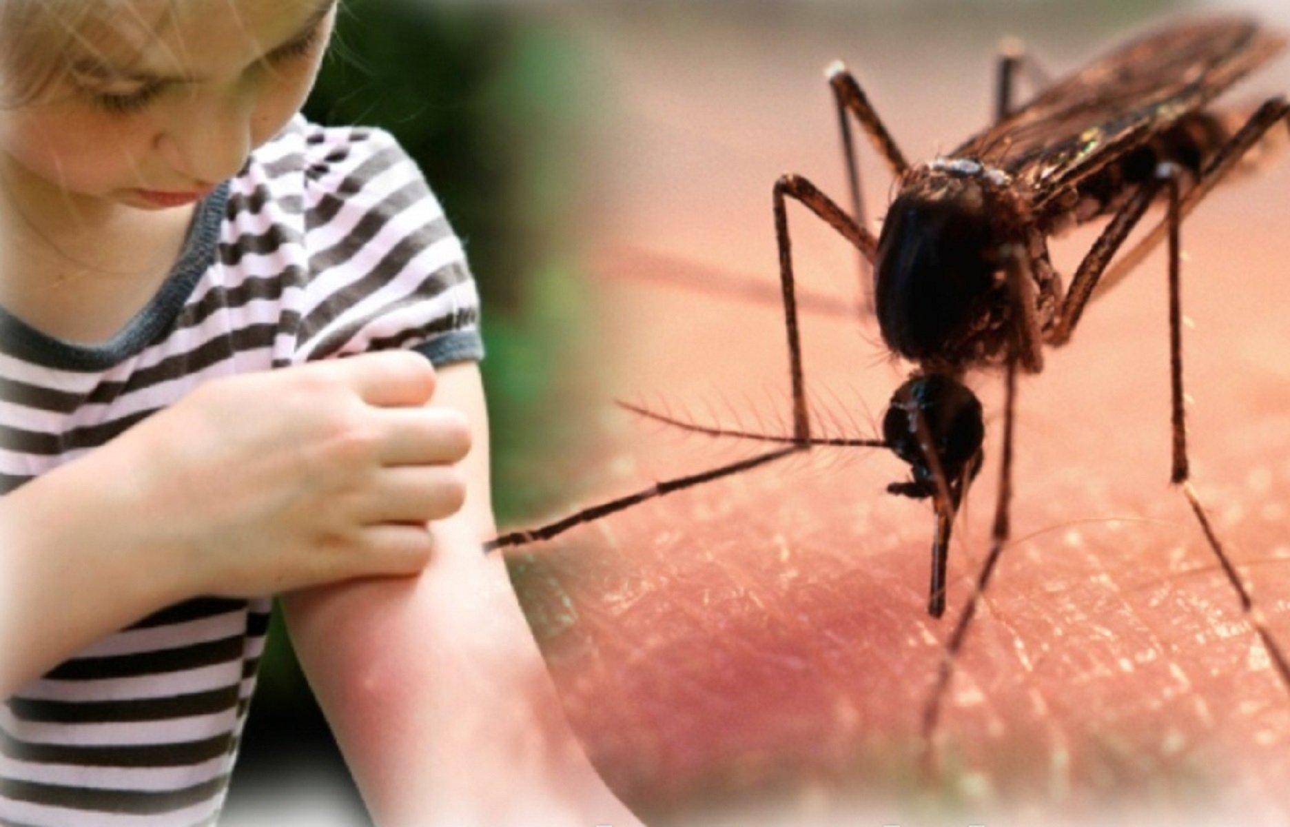 Почему кусают комары — особенности поведения кровососущих, поиск жертвы, опасность атаки