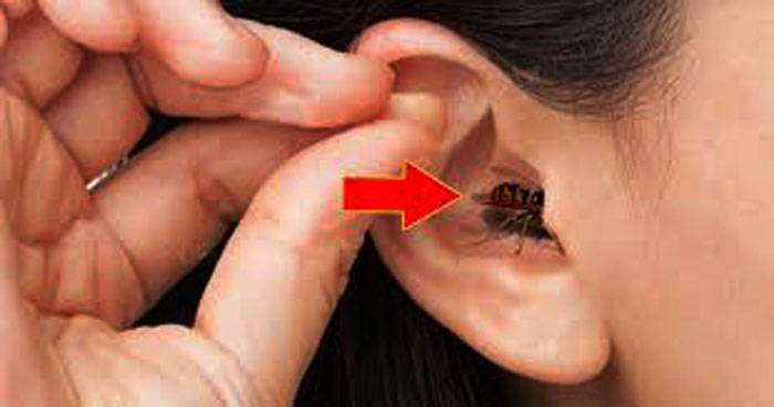 Первая помощь при попадании насекомого в ухо