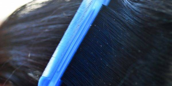 Убивает ли краска для волос вшей и гнид — проверенная информация